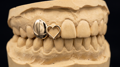 3D Heart grillz on dental mold