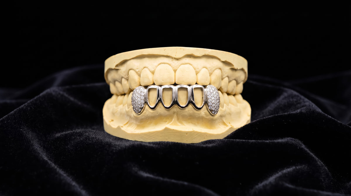 Open face silver grillz with two diamond-set teeth, 6 teeth bottom, on dental mold