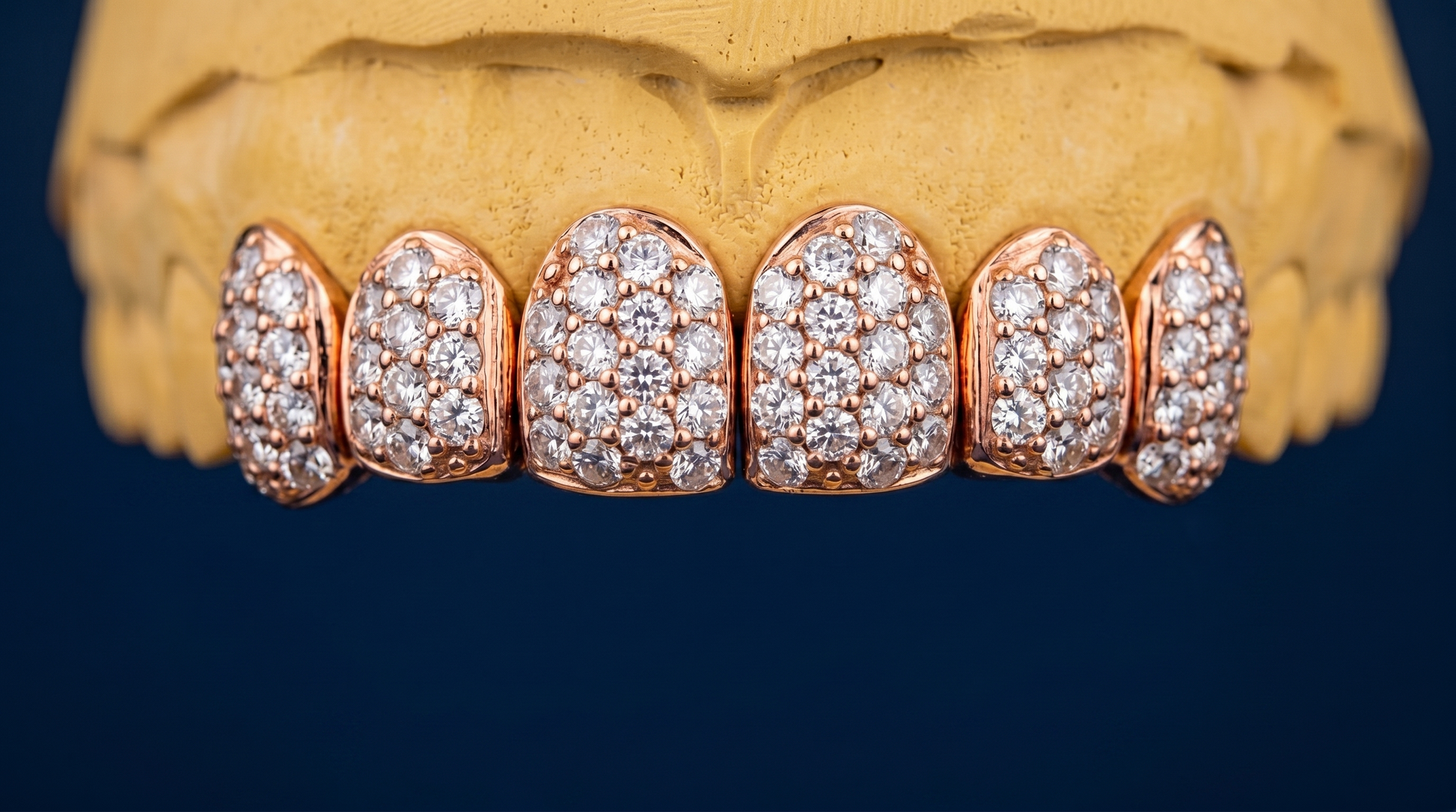 ICED VVS MOISSANITE GRILLZ