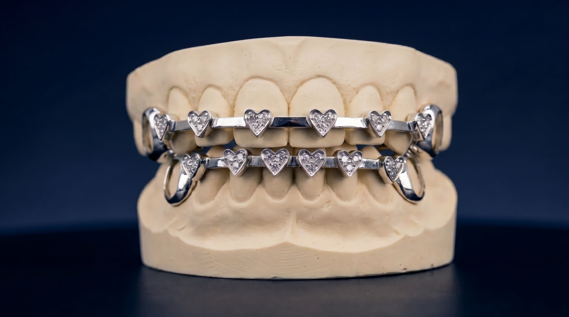 ICED VVS MOISSANITE HEART BRACES GRILLZ
