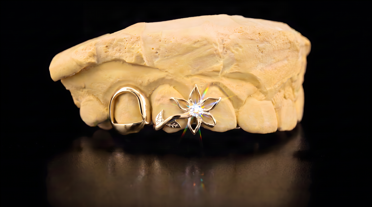 Flower Grillz - 10K Gold