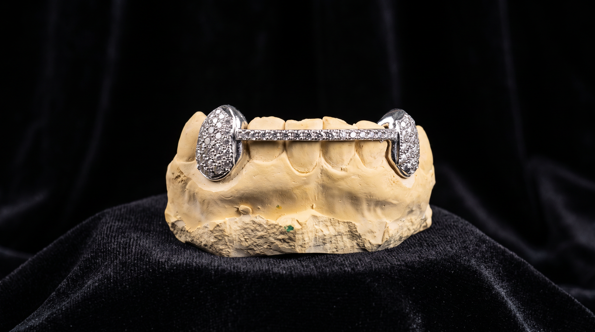 Full Diamond Wire Grillz