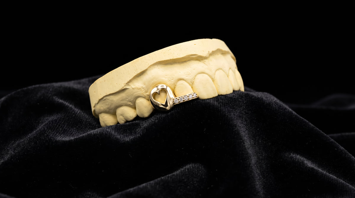 Heart cutout grillz with flat bar of diamonds in 10K gold on dental mold