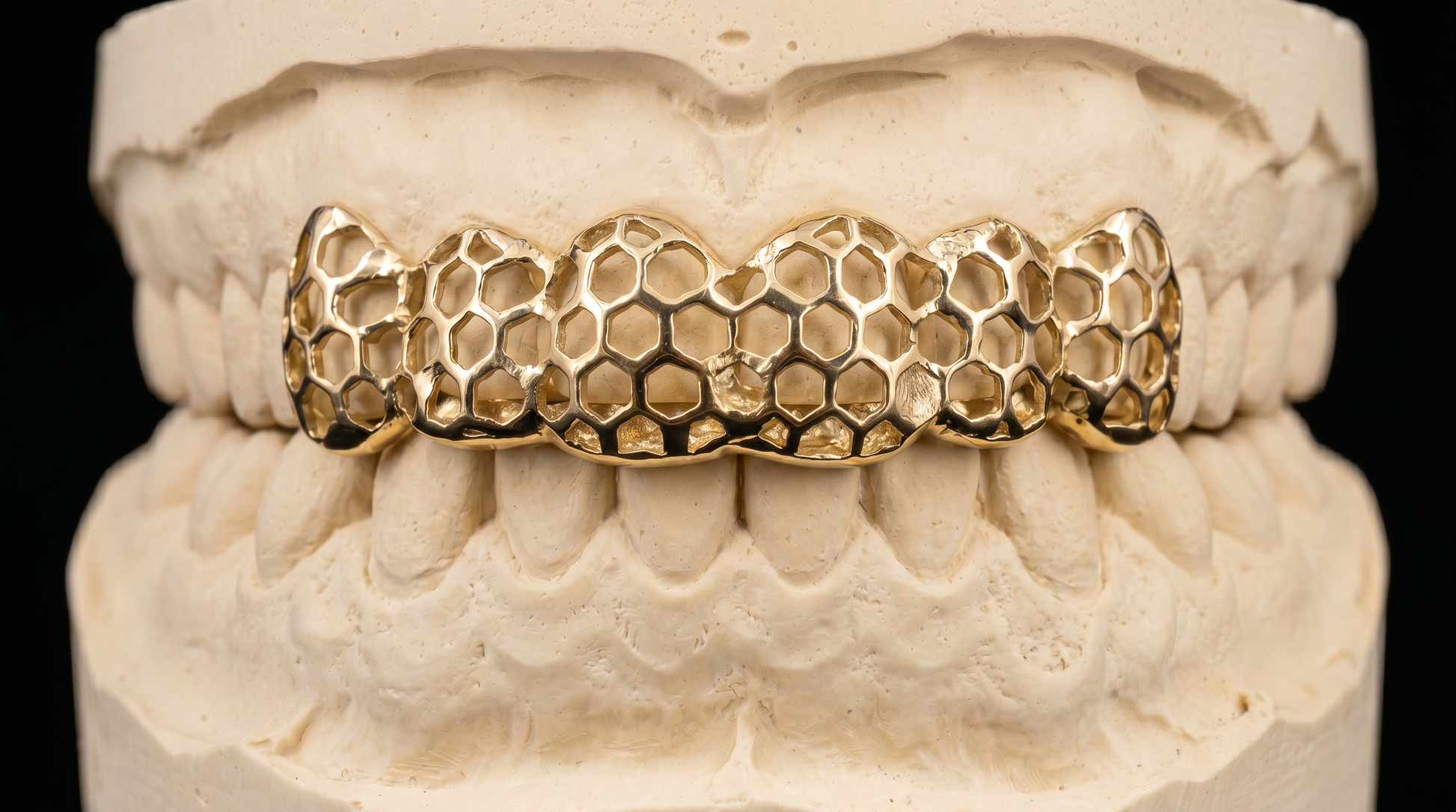 Honeycomb Grillz