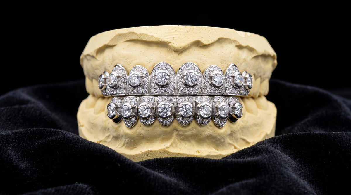 Honeymoon set diamond grillz, 8 top and 8 bottom, on dental mold