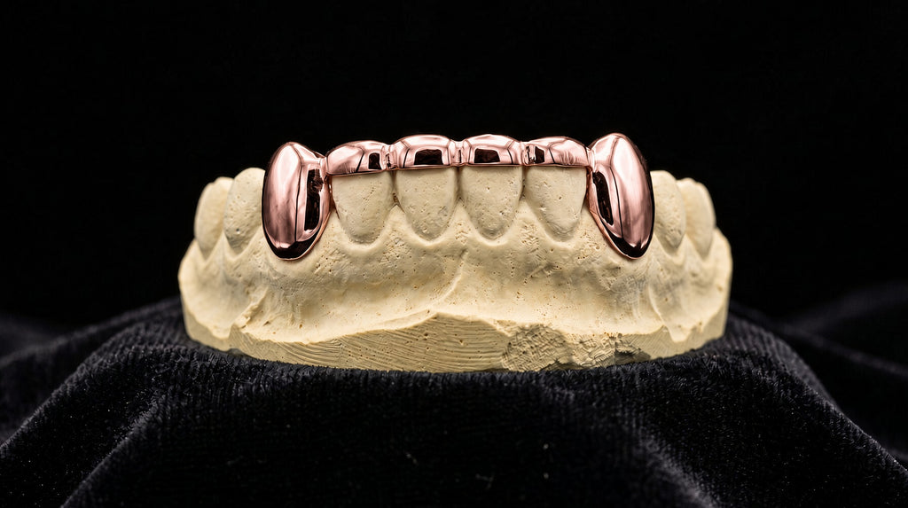 Front Bridge Gold Grillz - Rose Gold