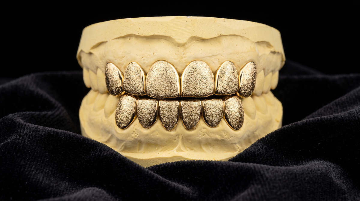 Diamond Dust Grillz - Yellow Gold