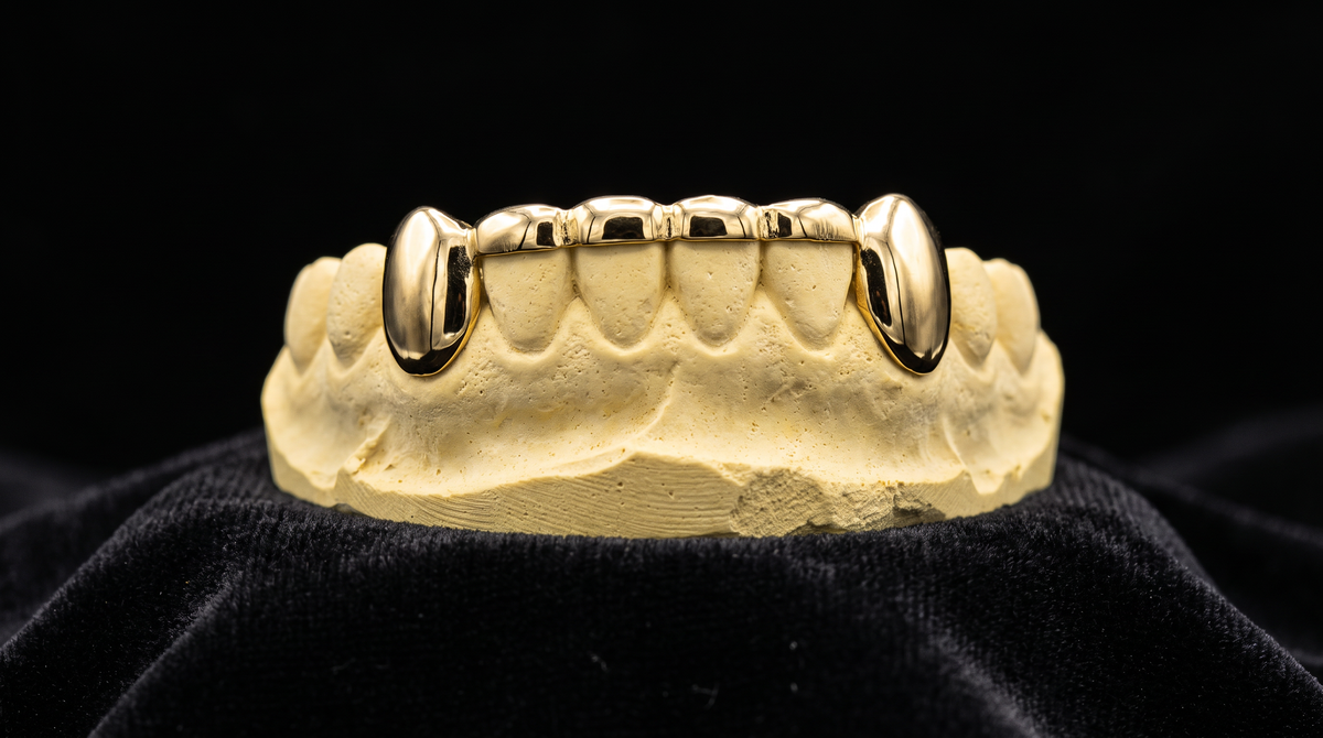 Front Bridge NPG Grillz